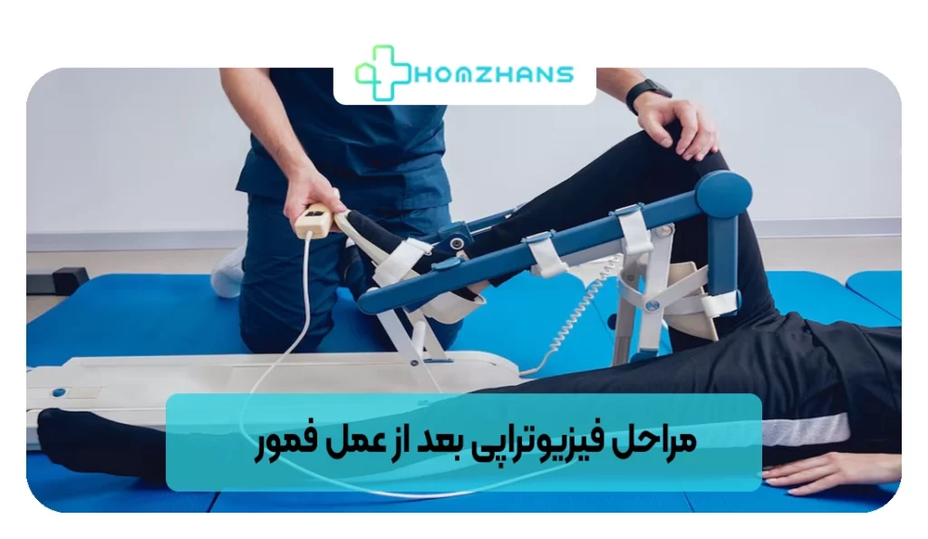 مراحل فیزیوتراپی بعد از عمل فمور | هومژانس