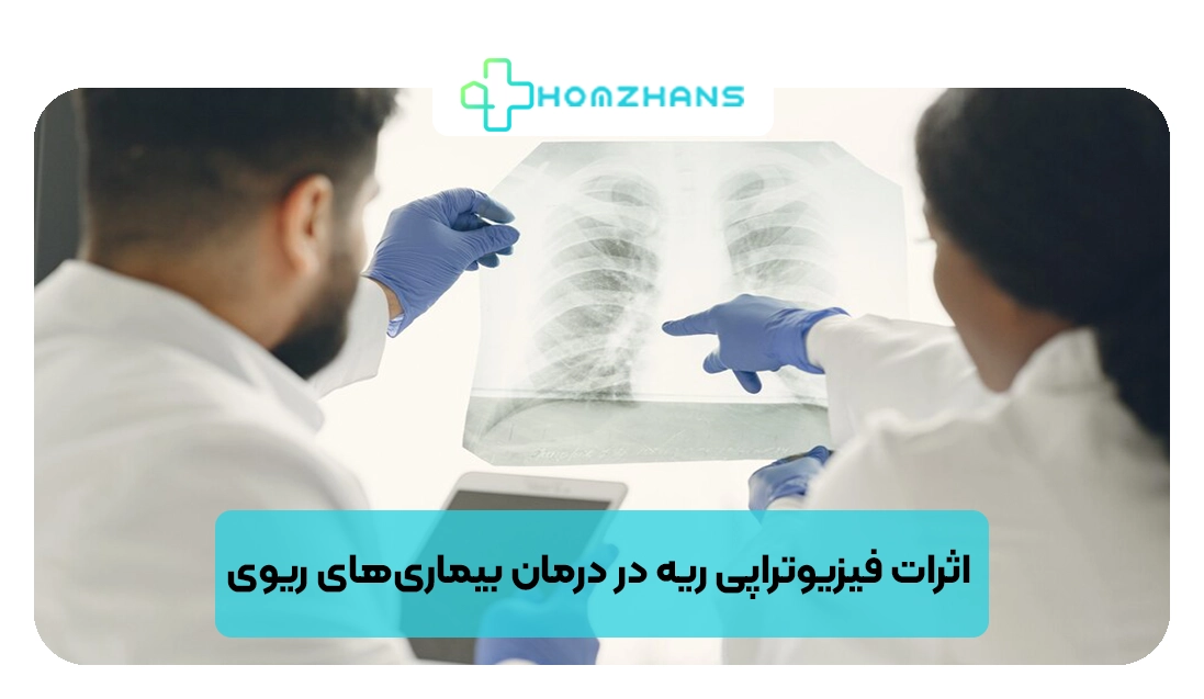 اثرات فیزیوتراپی ریه در درمان بیماری‌های ریوی | هومژانس