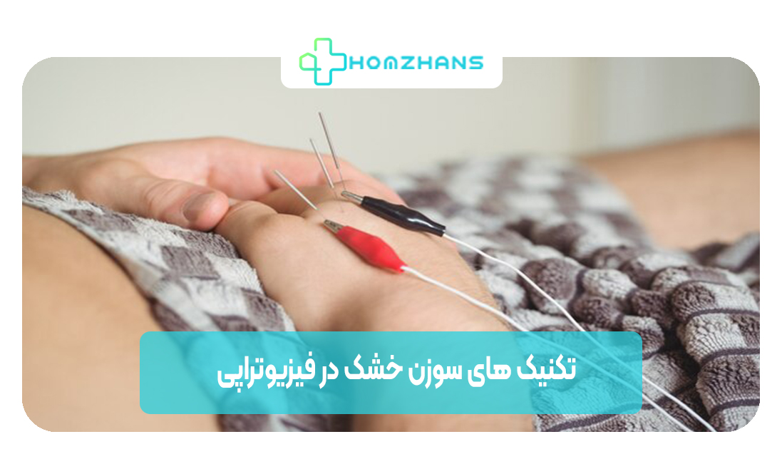 تکنیک های سوزن خشک در فیزیوتراپی | هوم ژانس