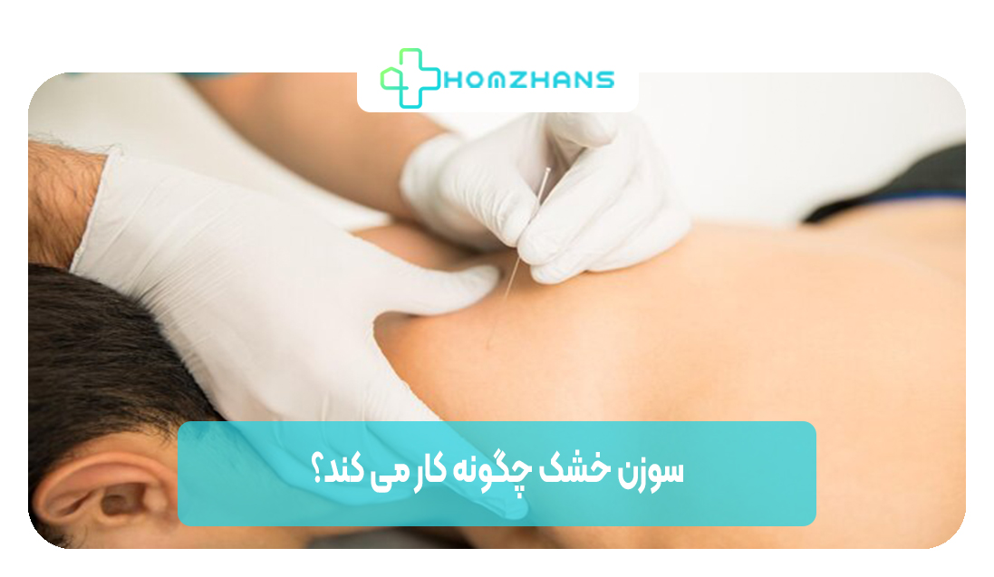 سوزن خشک چگونه کار می کند | هوم ژانس