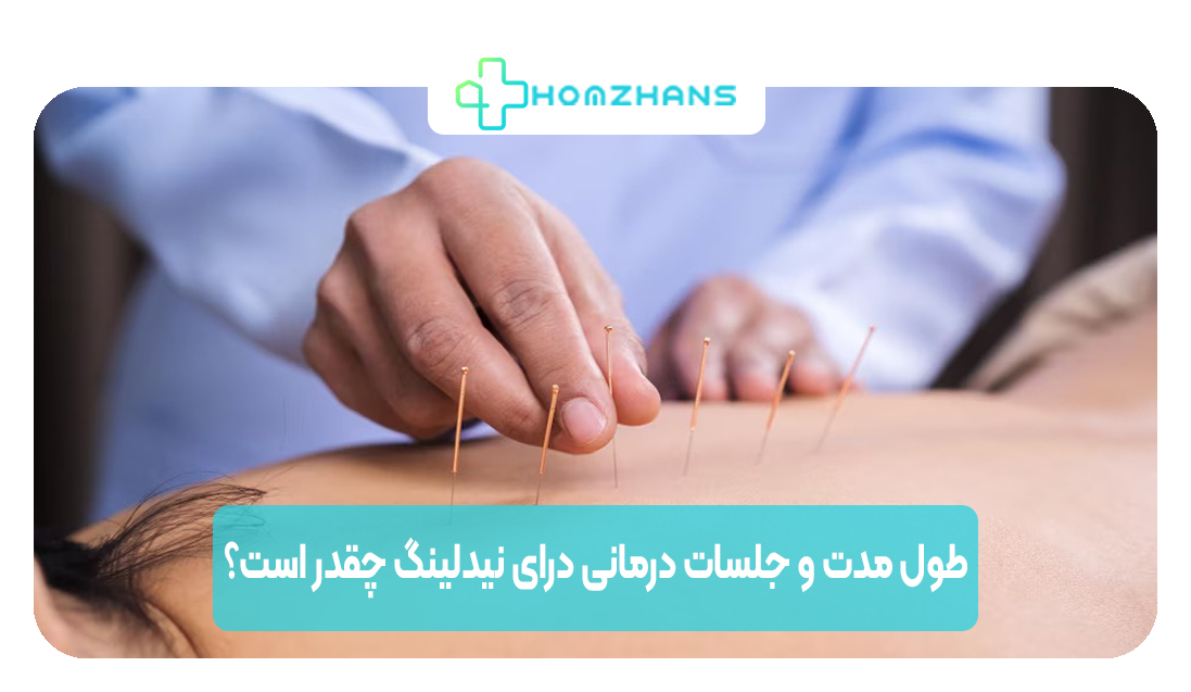 طول مدت و جلسات درمانی درای نیدلینگ چقدر است | هوم ژانس