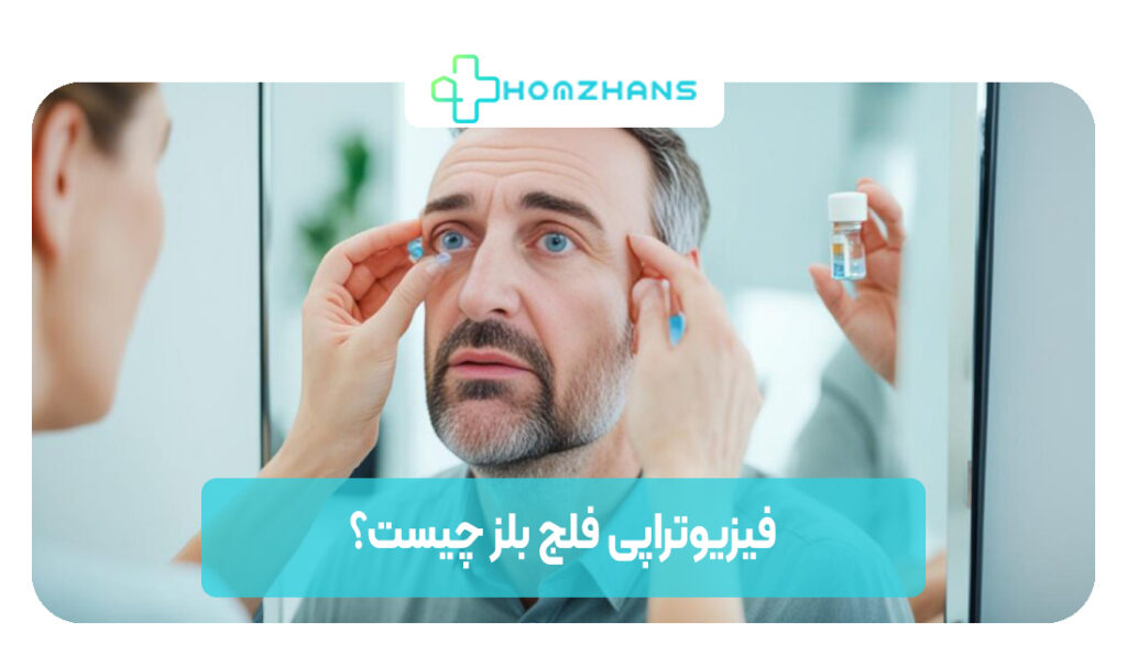 فیزیوتراپی فلج بلز چیست | هوم ژانس