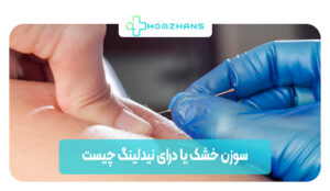 سوزن خشک یا درای نیدلینگ چیست | هوم ژانس