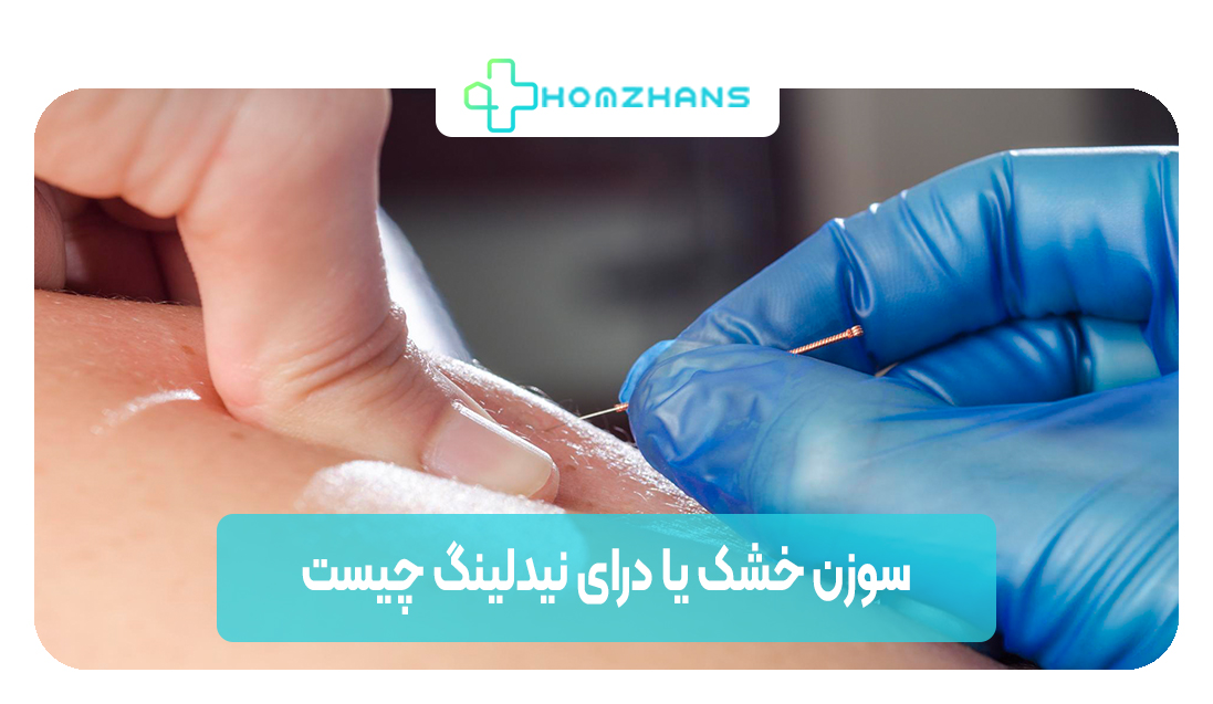 سوزن خشک یا درای نیدلینگ چیست | هوم ژانس