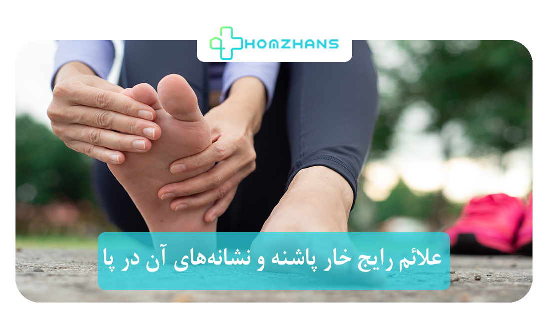 علائم رایج خار پاشنه و نشانه‌های آن در پا | هومژانس