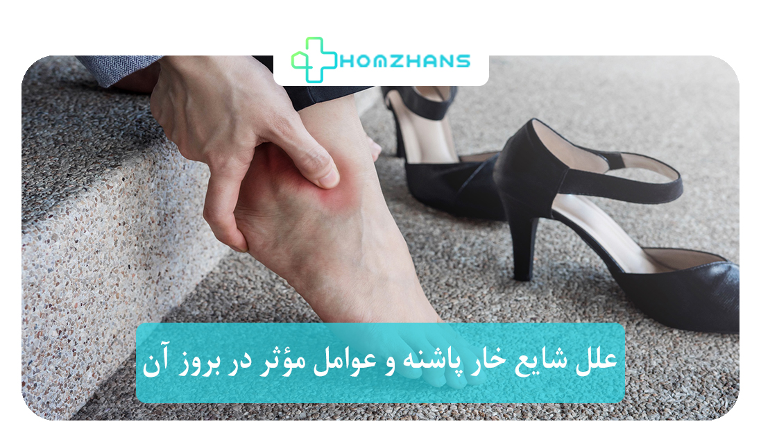 علل شایع خار پاشنه و عوامل مؤثر در بروز آن | هومژانس